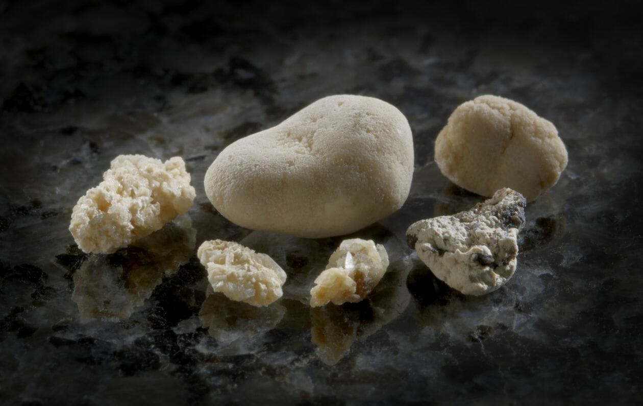 perro calculos oxalato calcio